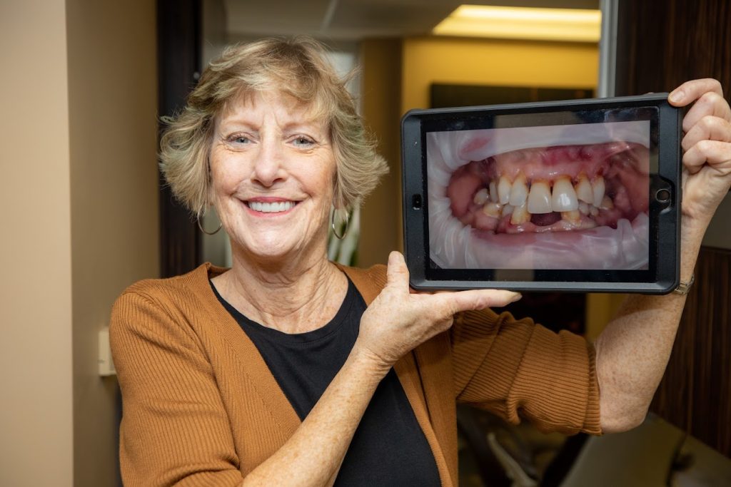 leslie all on 4 patient